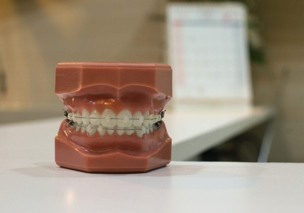 model of human teeth