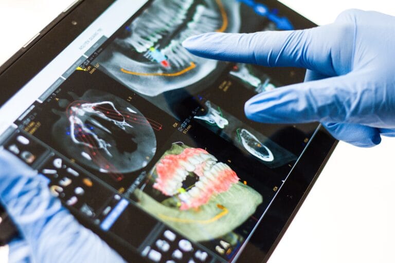 Dentist reviewing dental x-rays to plan wisdom teeth removal in Geelong